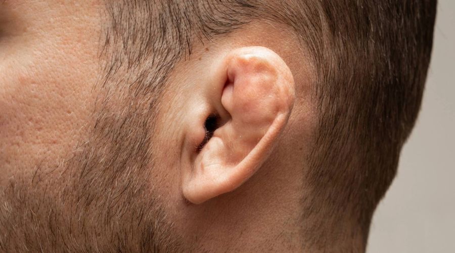 Cauliflower Ear BJJ